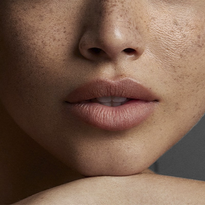 Cómo recuperar tus labios